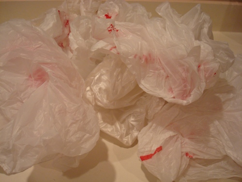 Too many plastic bags